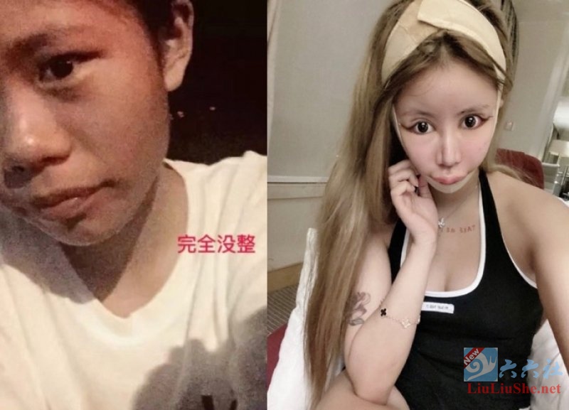 想红想疯了!网红「小z娜娜Nana」整形60次-伊尤台